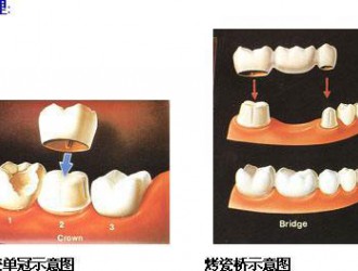 口腔治療中的騙局都有哪些？這些坑不要踩！