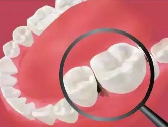 吃東西老是塞牙，牙縫里很臭怎么辦？