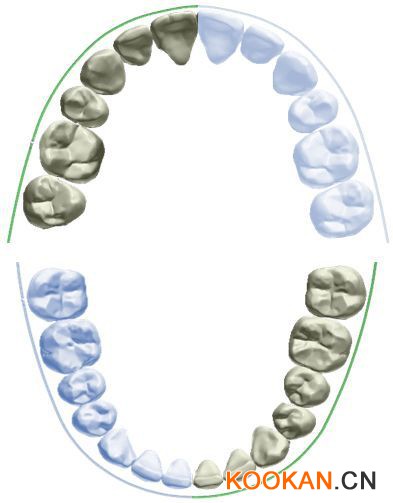 海量個性化美學弓形數(shù)據(jù)