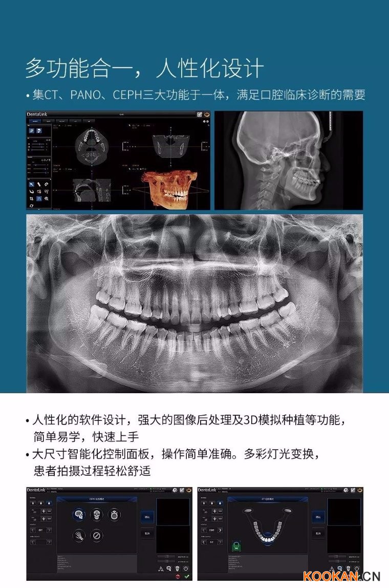 菲森CBCT多功能合一，人性化設(shè)計