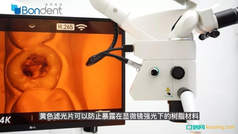 西默顯微大課堂⑤——倍率、光源與濾光片的調(diào)節(jié)使用