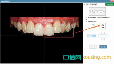 DSD美學設(shè)計口腔管理軟件鏡像工具實現(xiàn)高效化調(diào)整