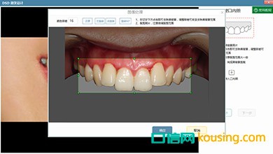 DSD美學微笑設(shè)計口腔管理軟件工具多樣調(diào)試